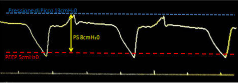 Livelli di pressione