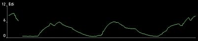 Edi