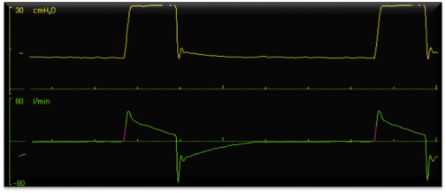 autociclaggio post triggerlab 2