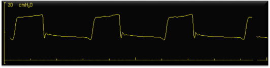 autociclaggio post triggerlab