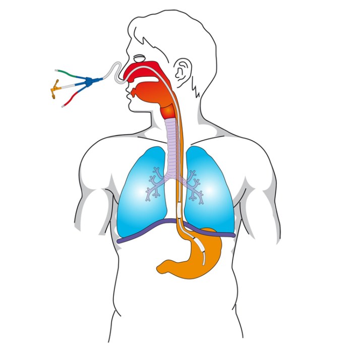 La pressione esofagea: applicazioni cliniche