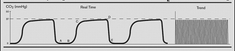 capnogram-jpg