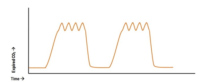 Cardiac-oscillations