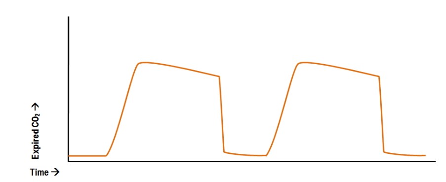 Reversal-of-alveolar-slope-in-emphysema