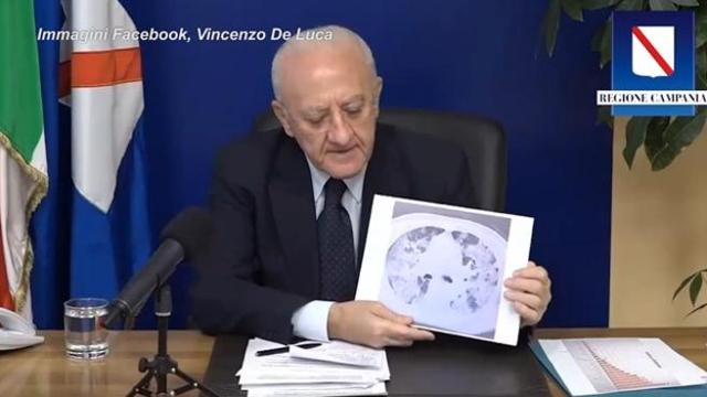 Infermiere di anestesia e trapianto&nbsp;polmonare