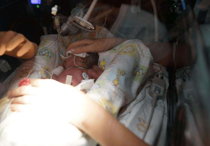 Neurally Adjusted Ventilatory Assist nel&nbsp;neonato